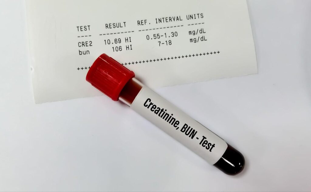 BUN  Creatinine Ratio